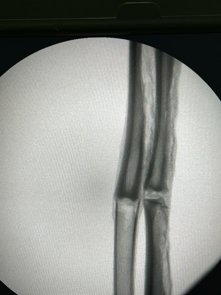 60cm Specimen Arm