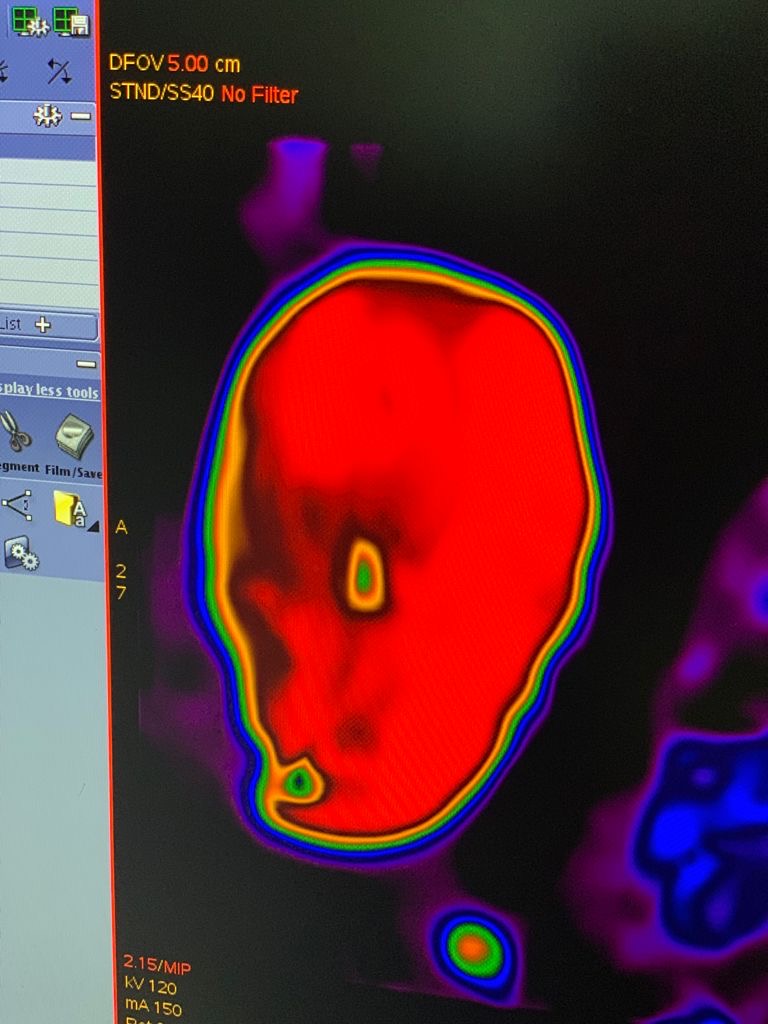 Medical Scan of 60cm Specimen