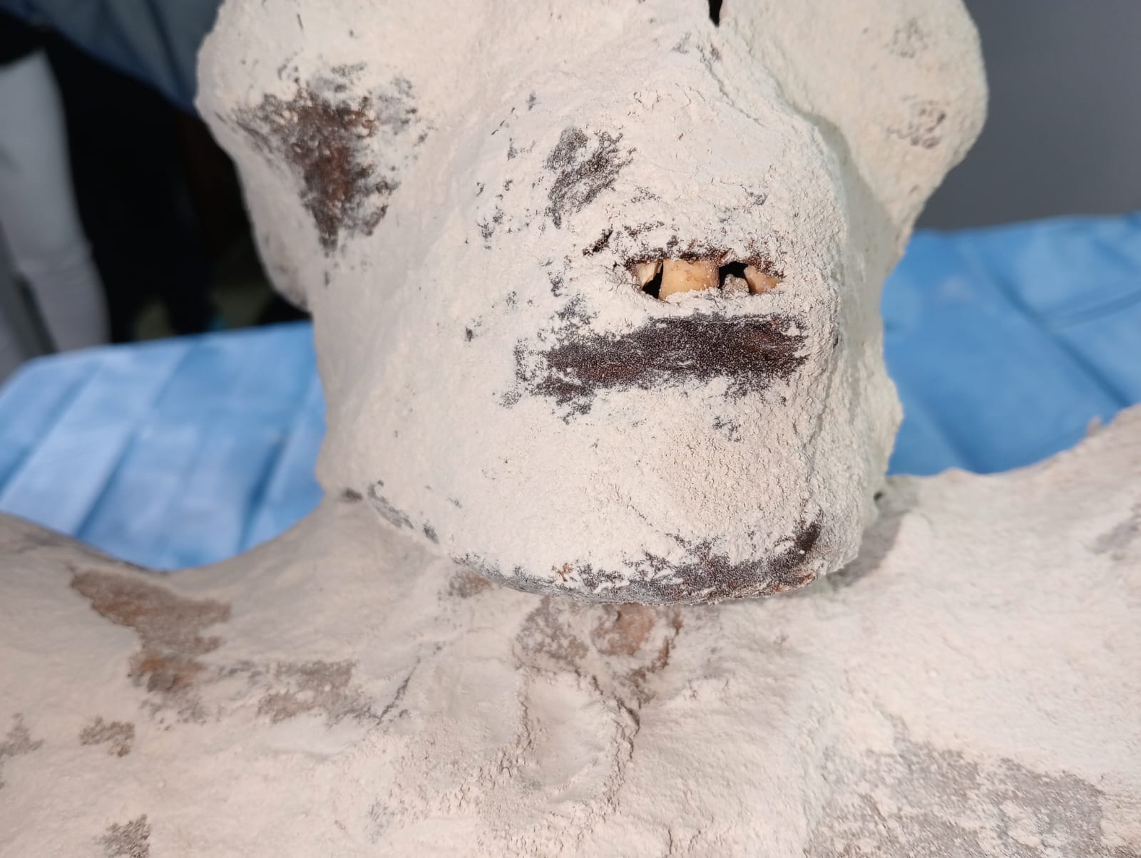 Jois Teeth