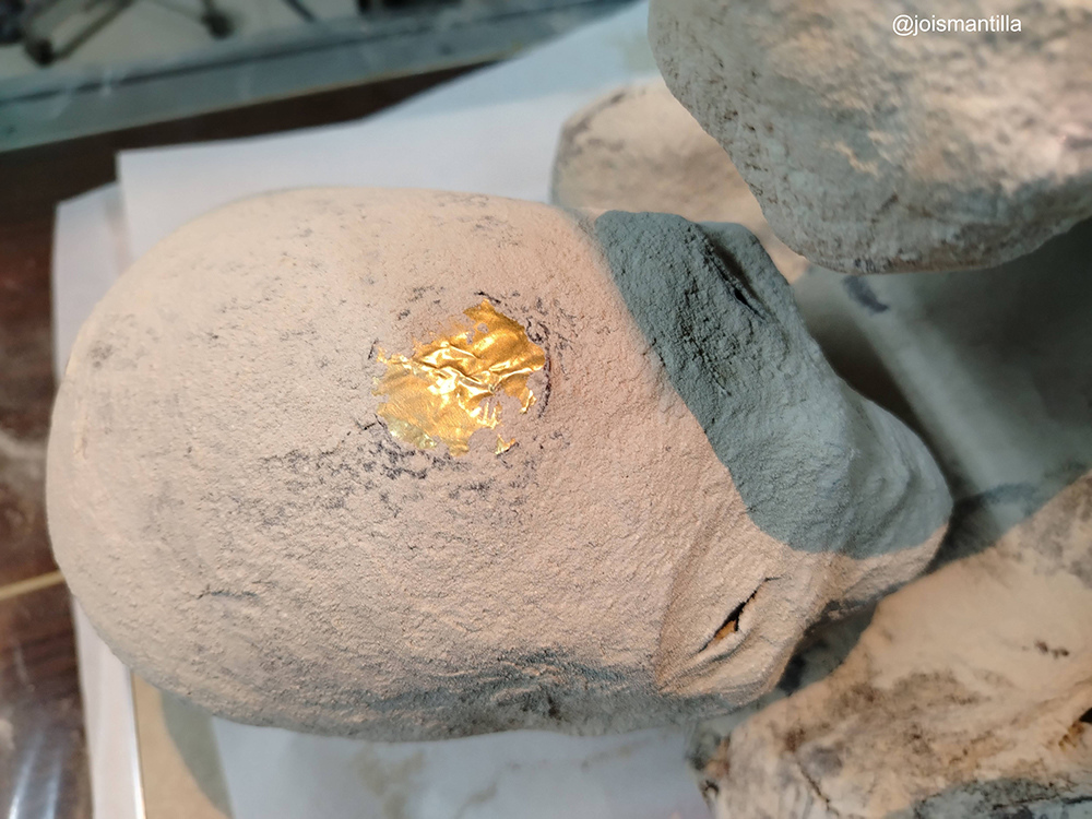 Montserrat Montserrat Implant