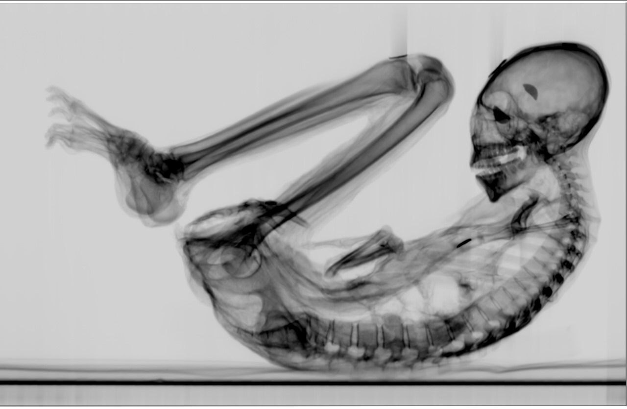 Medical Scan of Montserrat