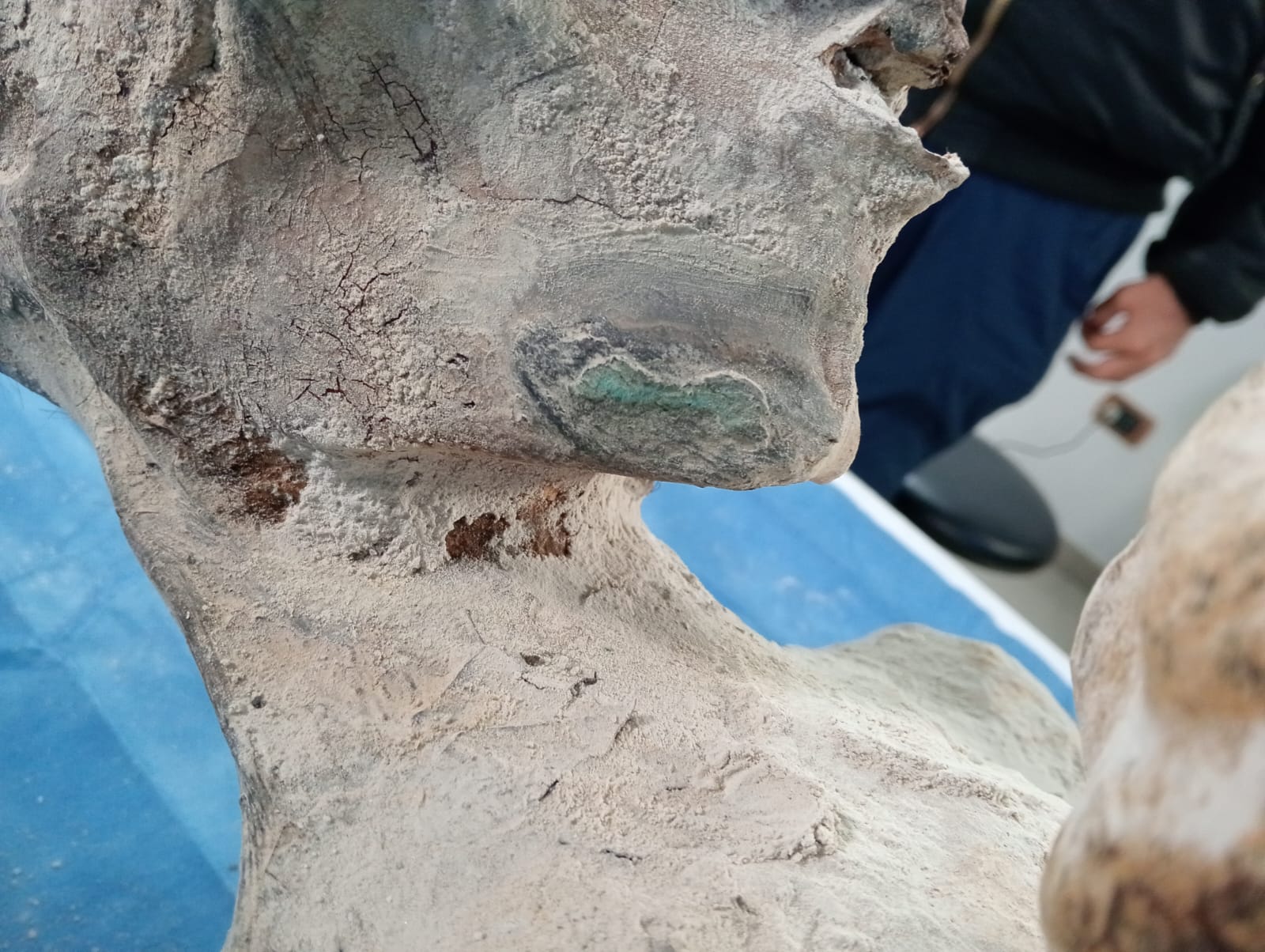 Paloma Implant