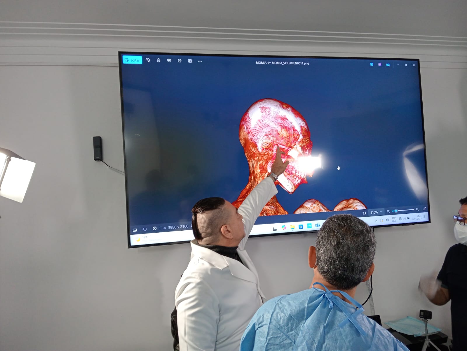 Paloma Vela Implant